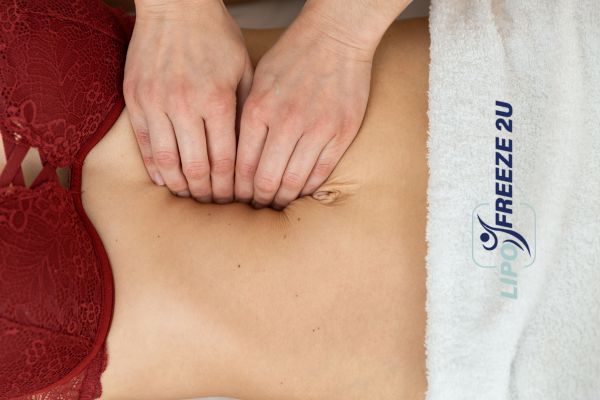 diastasis recti treatment Cambridgeshire