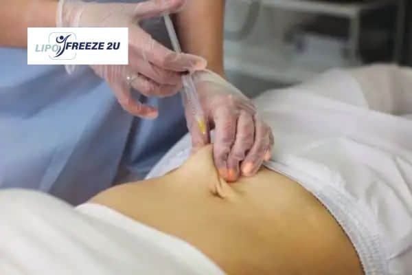 How Does Aqualyx Fat Dissolving Injection Work to Break Down Fat Cambridgeshire?