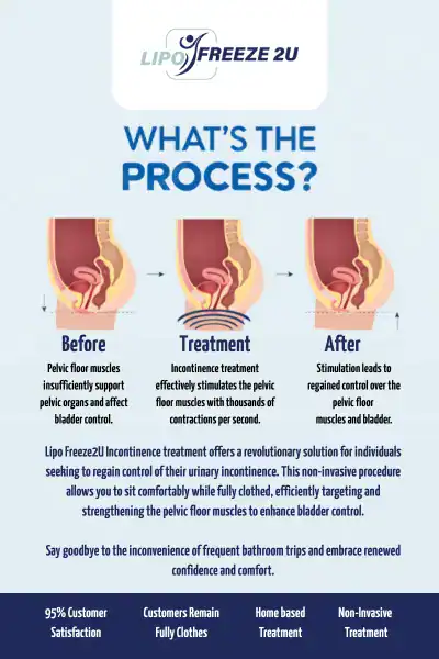 Diagram of how incontinence treatment Cambridgeshire works.
