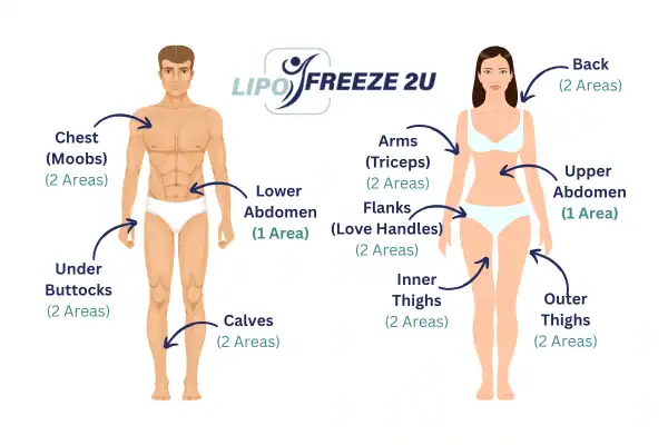 Areas you can have fat freezing treatment Cambridgeshire
