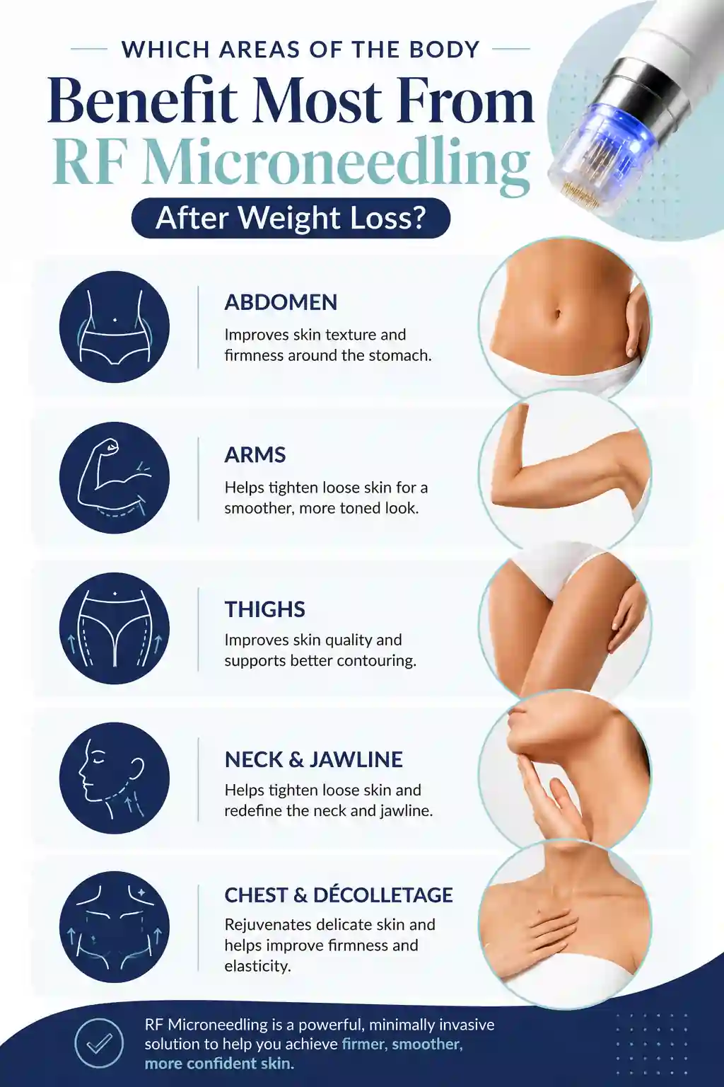 Which Areas of the Body Benefit Most From RF Microneedling After Weight Loss Cambridgeshire